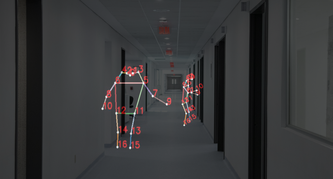 Privacy-preserving Computer Vision in Hospitals: Real-time movement analysis with deep learning 