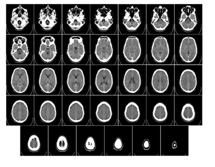 Cancer detection 