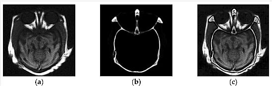 Image Fusion in Medical Imagery 