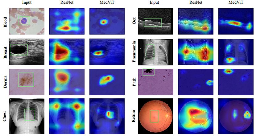 MedViT-T and ResNet-18 Recognition on MedMNIST-2D datasets 